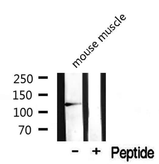 SKP2 Antibody
