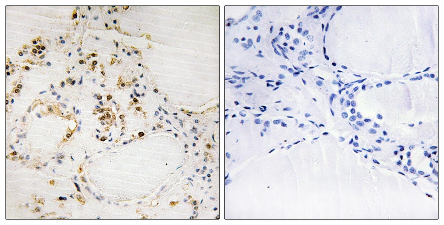 BCL2 / Bcl-2 Antibody (phospho-Ser87)