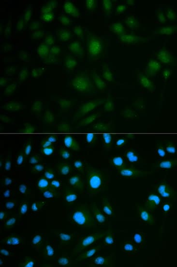 IL23R Antibody