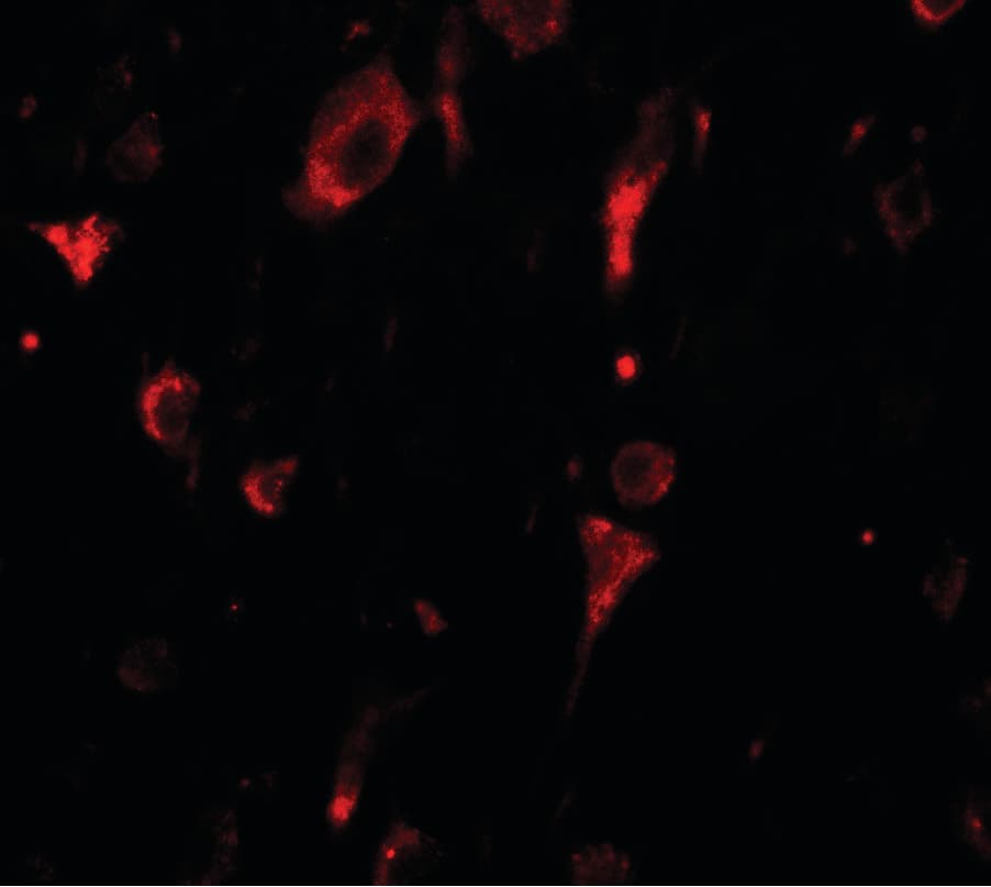IHC-plus™ SGSM2 Antibody