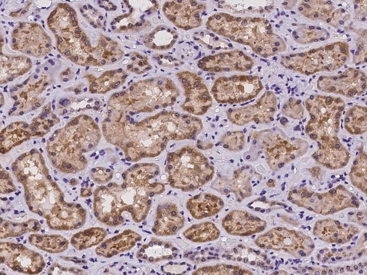 OSBPL9 Antibody
