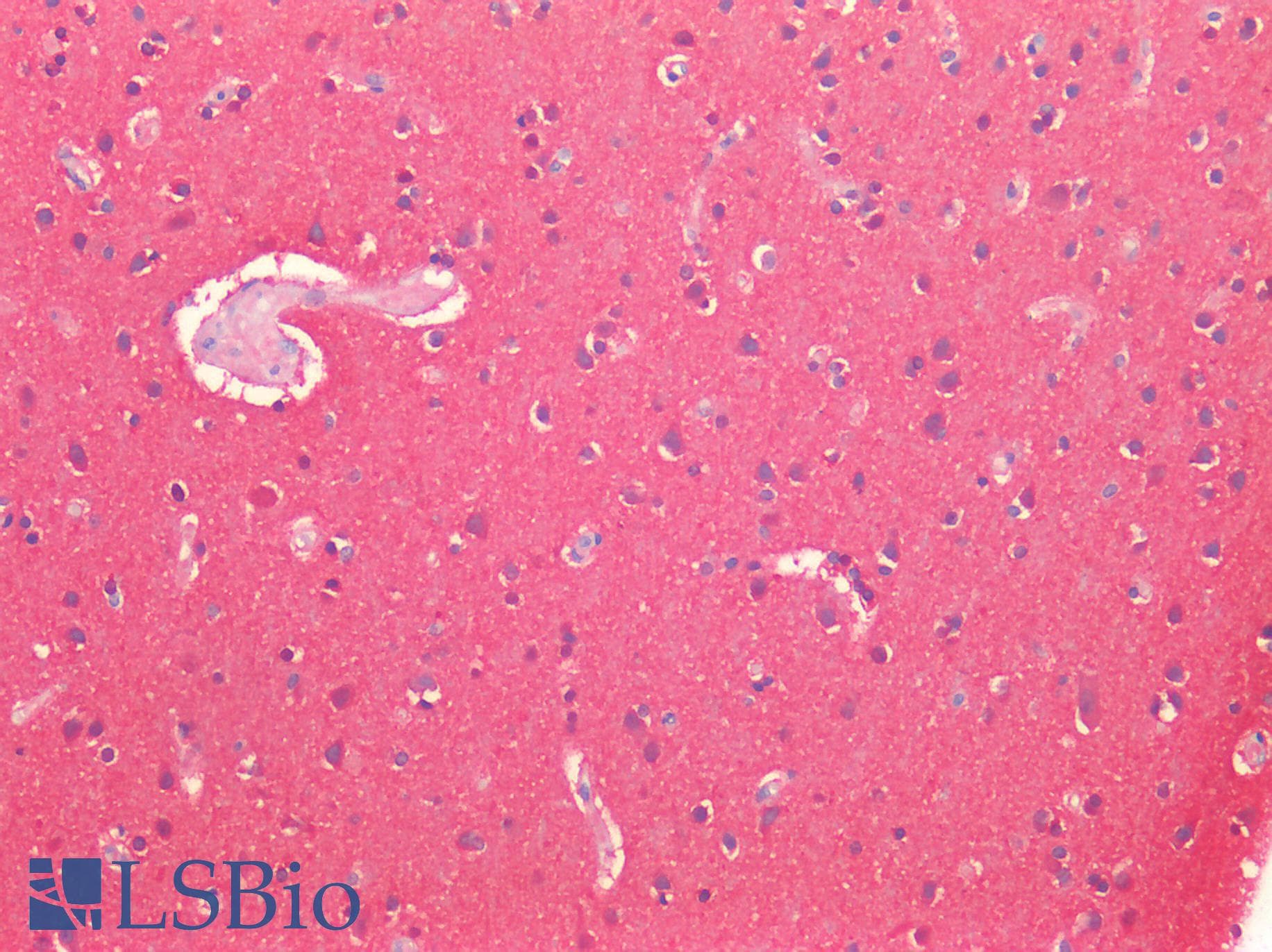 PathPlus™ UCHL1 / PGP9.5 Antibody