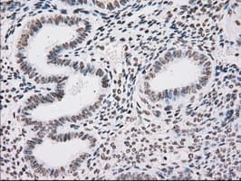 TYRO3 Antibody (clone OTI5B4)