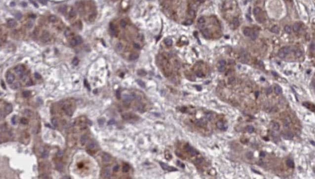 Polyclonal Rabbit anti-Human GPR20 Antibody (IHC, IF, WB)