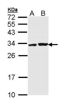 IHC-plus™ Polyclonal Rabbit anti-Human APIP Antibody (IHC, WB)