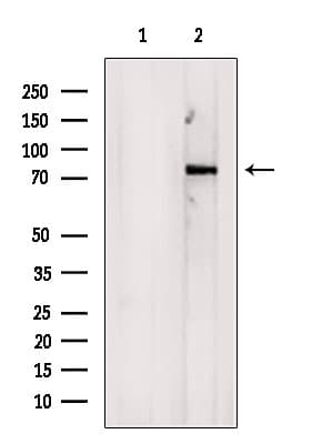 COL23A1 / Collagen XXIII Antibody