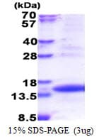 Human TIMM8A Protein (Recombinant His)
