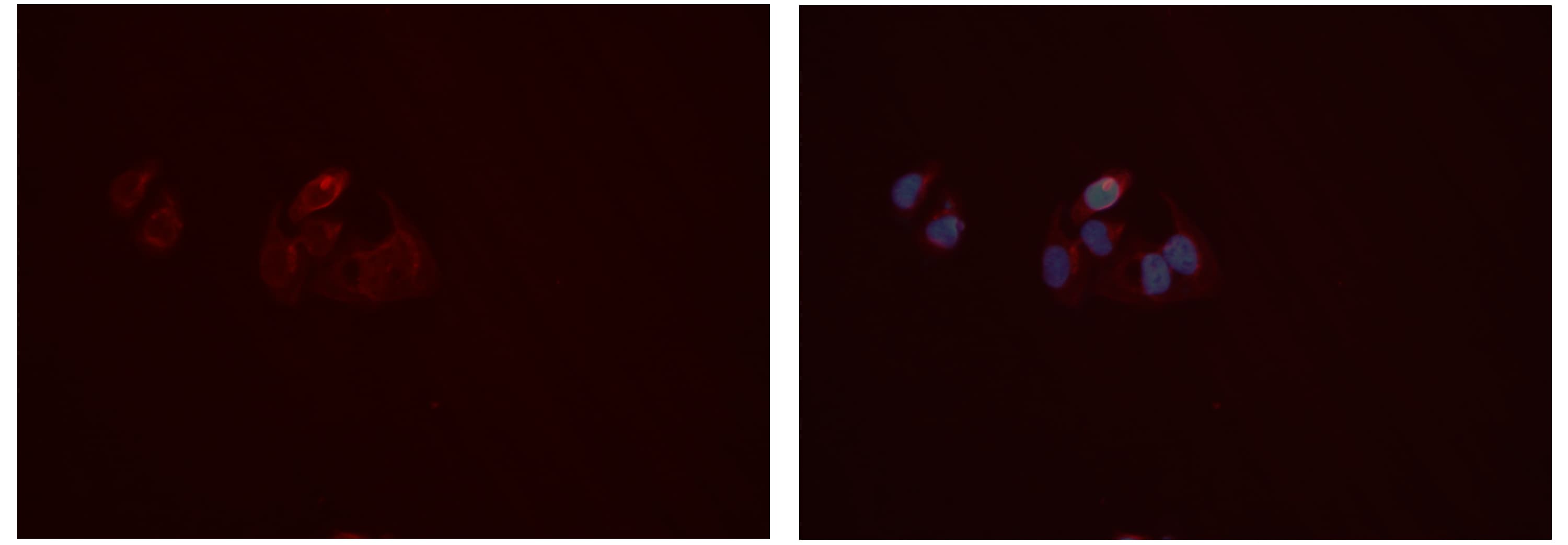 MMP10 Antibody