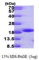 Human NME3 Protein (Recombinant His)