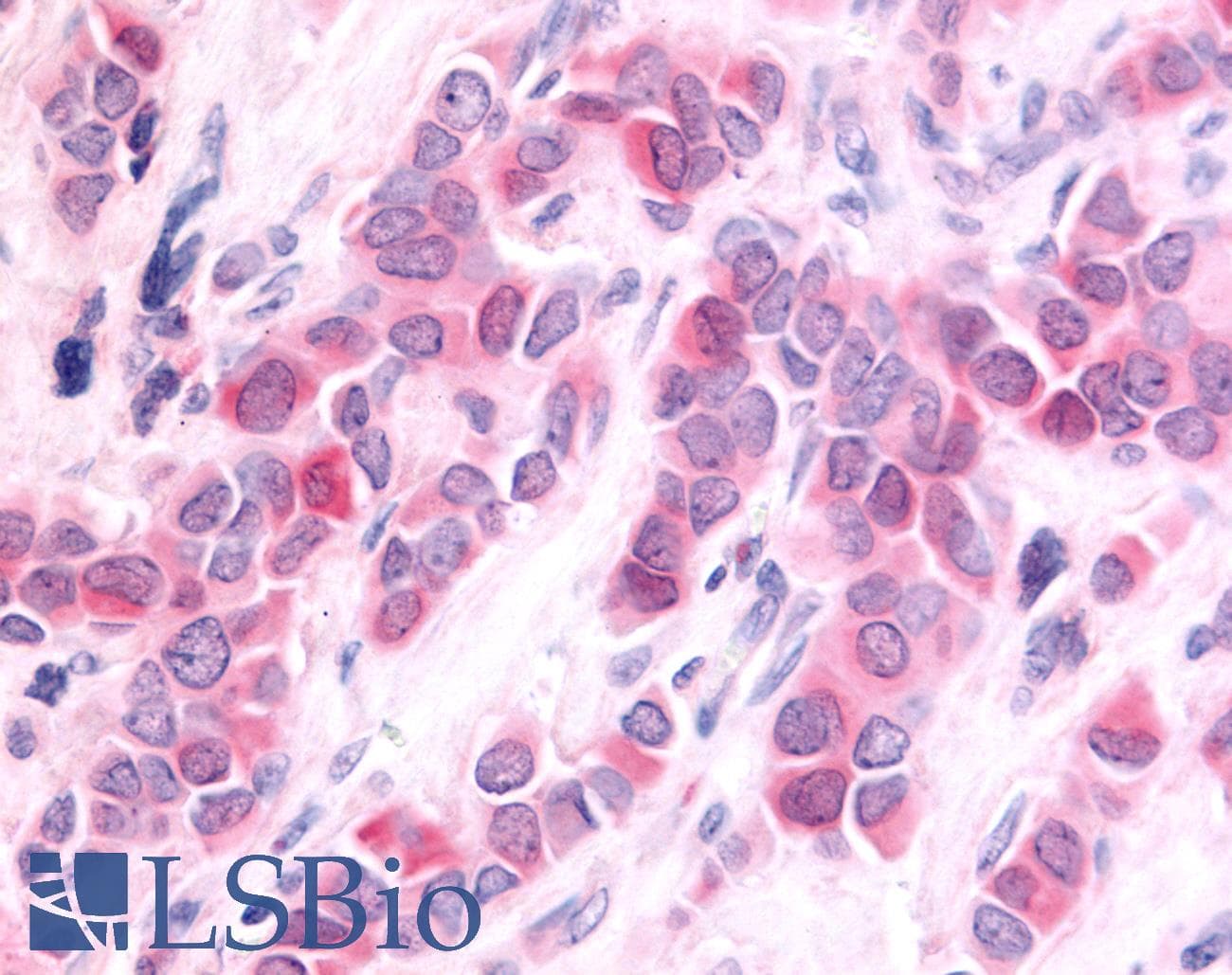 PathPlus™ Polyclonal Rabbit anti-Human HUNK / B19 Antibody (Internal, IHC)