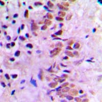 Polyclonal Rabbit anti-Human E2F1 Antibody (C-Terminus, IHC, WB)