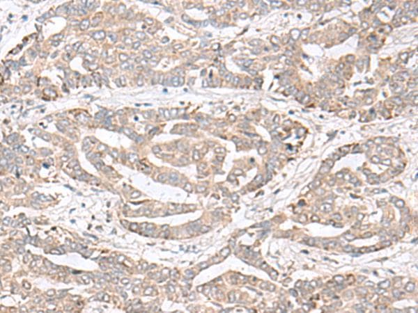 CHST4 / GlcNAc6ST2 Antibody