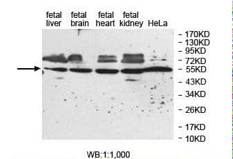 Polyclonal Rabbit anti-Human ZNF774 Antibody (aa142-422, IHC, WB)