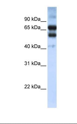 RARG / RAR-Gamma Antibody (aa36-85)