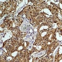 Monoclonal Mouse anti-Human HSPA8 / HSC70 Antibody (IHC, WB)