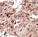 PHKG1 Antibody (aa302-332)
