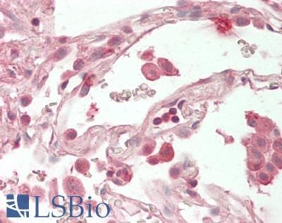 IHC-plus™ GOLGA1 / Golgin-97 Antibody
