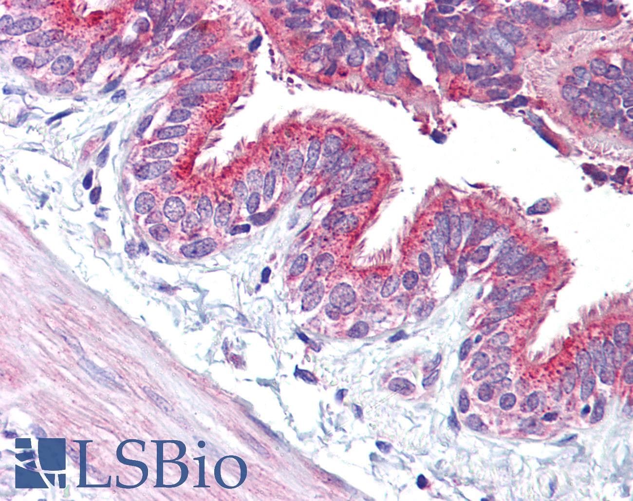 PathPlus™ CCNE1 / Cyclin E1 Antibody (aa91-140)