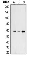 Polyclonal Rabbit anti-Human USP30 Antibody (N-Terminus, IF, WB)