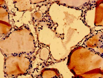NUMA1 / NUMA Antibody