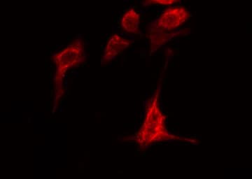 Polyclonal Rabbit anti-Human ADAMTS1 Antibody (IHC, IF, WB)