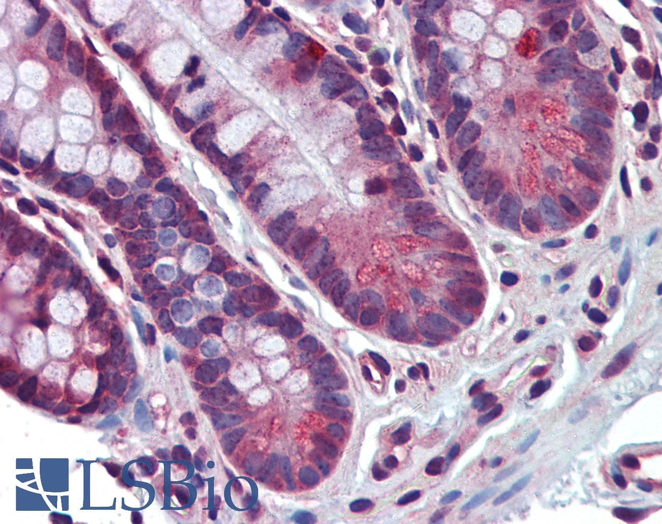 IHC-plus™ Polyclonal Rabbit anti-Human KIAA1840 / SPG11 Antibody (IHC, WB)