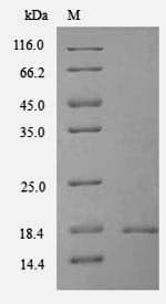 Mouse TXNDC12 Protein (Recombinant 6His, N-terminus)