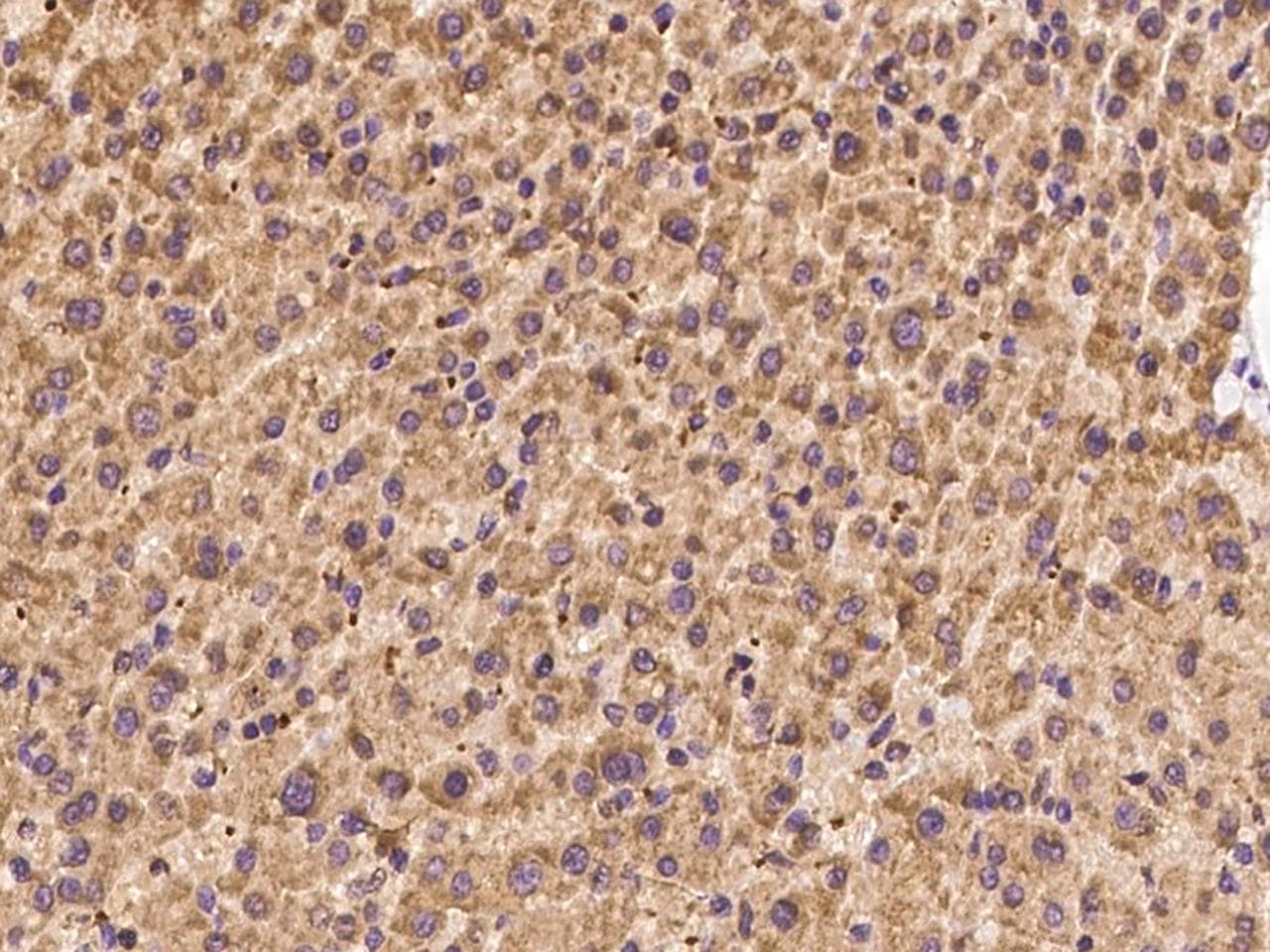 PET117 Antibody