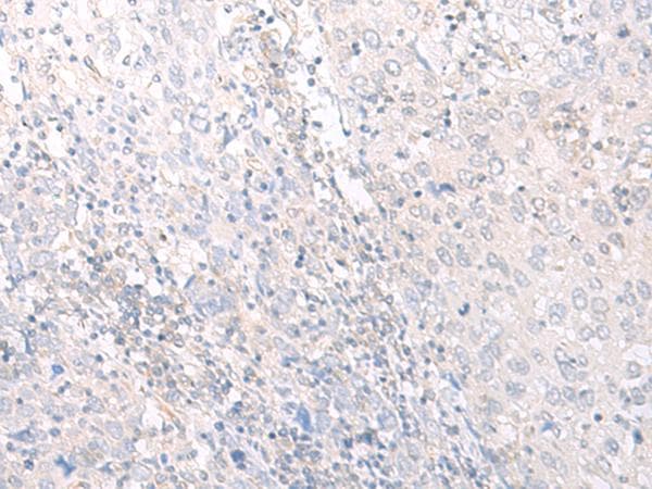 HLA-C Antibody