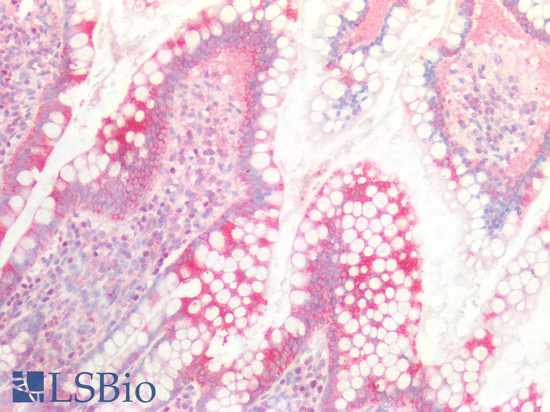 PathPlus™ KRT5 / CK5 / Cytokeratin 5 Antibody