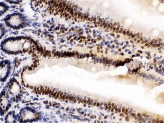 HMG2 / HMGB2 Antibody