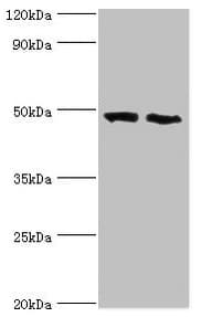 IHC-plus™ FDFT1 / Squalene Synthase Antibody (aa1-260)