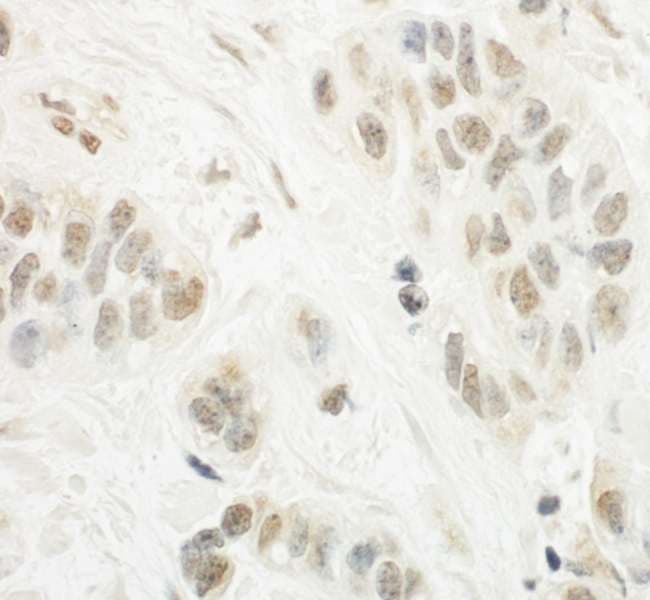 Polyclonal Rabbit anti-Human NCKIPSD / AF3P21 Antibody (aa600-650, IHC)
