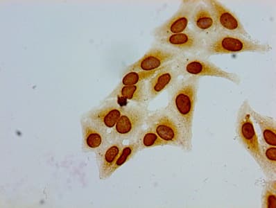 HIST1H1E Antibody