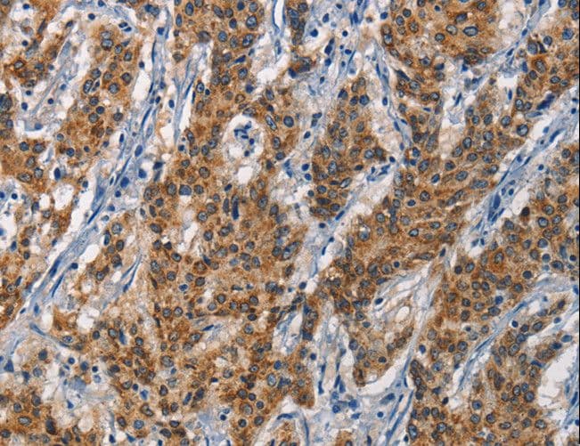 IHC-plus™ APOL1 / Apolipoprotein L Antibody