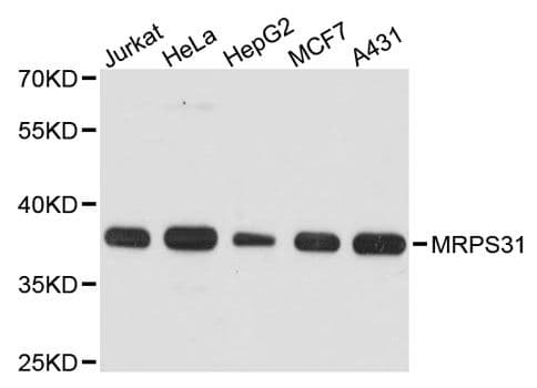 MRPS31 Antibody
