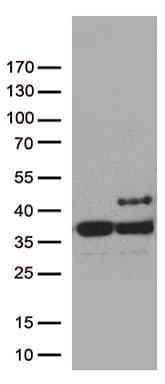 Monoclonal Mouse anti-Human SDHB Antibody (clone UMAB268, IHC, WB)