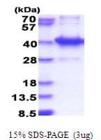 Human AMMECR1L Protein (Recombinant His)