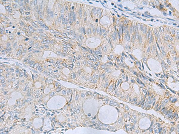 MSI2 Antibody