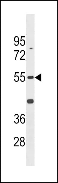 PFTK1 / CDK14 Antibody (aa45-72)