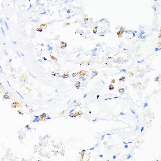 LL37 / Cathelicidin Antibody