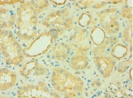 CARD10 / CARMA3 Antibody (aa863-1032)