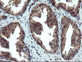PPAT Antibody (aa42-278, clone OTI1B11)