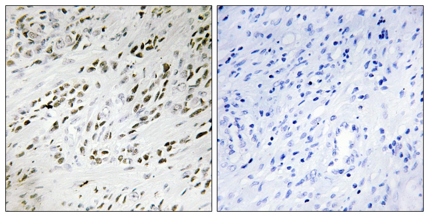 TSHZ2 Antibody