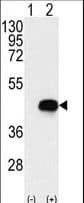 Polyclonal Rabbit anti-Human BCKDK Antibody (aa120-151, IHC, WB)