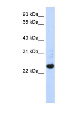 SPATC1L / C21orf56 Antibody (N-Terminus)