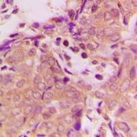 B3GALTL Antibody (C-Terminus)