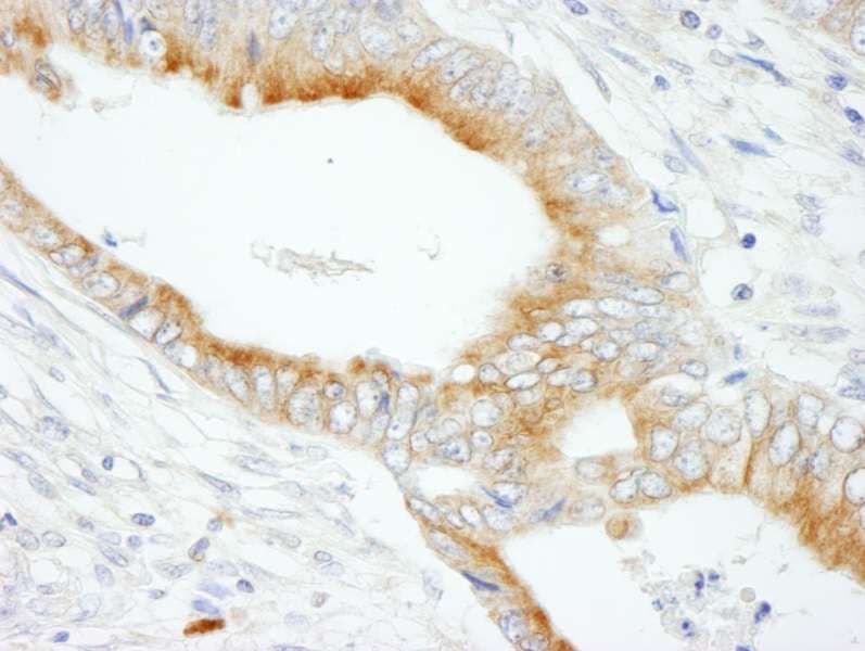 Polyclonal Rabbit anti-Human MAP7 Antibody (aa690-720, IHC, WB)