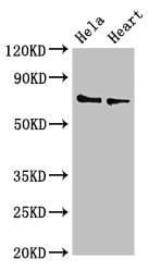 PLS3 / T Plastin Antibody