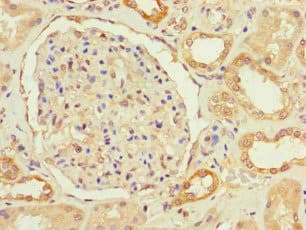 PRMT9 / PRMT10 Antibody